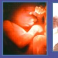 Pro-life collage Pro-life collage