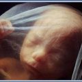 The Gift and Rights of Being Conceived, Part 1